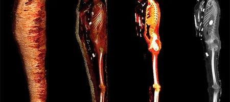 Radiologists Use CT Scans to ‘Digitally Unwrap’ Egypt’s Mummified ‘Golden Boy’