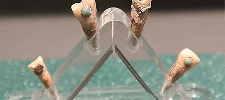 Glue Used by Ancient Maya Dentists to Affix Gems to Teeth Delivers Bonus Benefit
